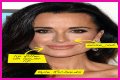Botox, Implants & More! – Hollywood Life