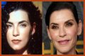 Julianna Margulies Doesn’t Look Natural After Plastic Surgery!